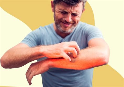 4 Ways To Treat Jock Itch: Complete Guide 2024 4 Ways To Treat Jock ...