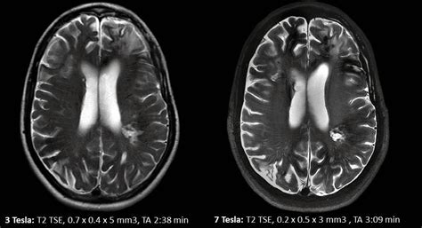 Cambridge extends world leading role for medical imaging with powerful ...
