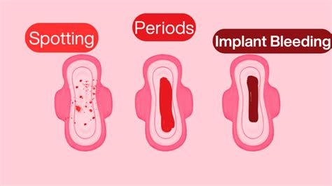 Spotting vs Period vs Bleeding: How To Identify
