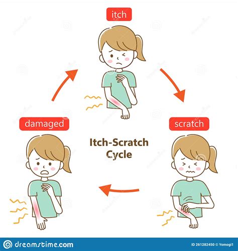 Itch Scratch Cycle Young Woman Illustration. Dry, Dermatitis And Atopic ...