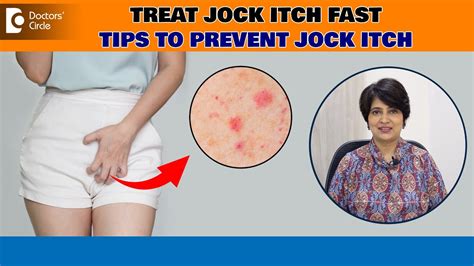 Jock Itch (Tinea Cruris)| Best ways to avoid Itching Down There - Dr ...