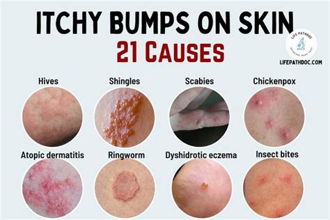 Itchy Bumps on Skin: 21 Causes, Pictures, and Treatment