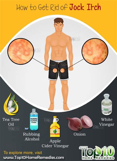 Itch - bestyup